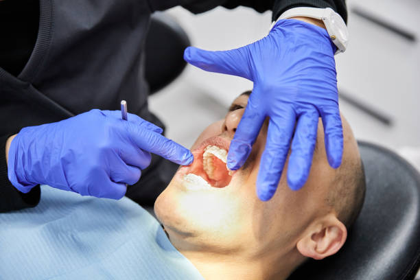 Best Emergency Root Canal Treatment in Washington, UT